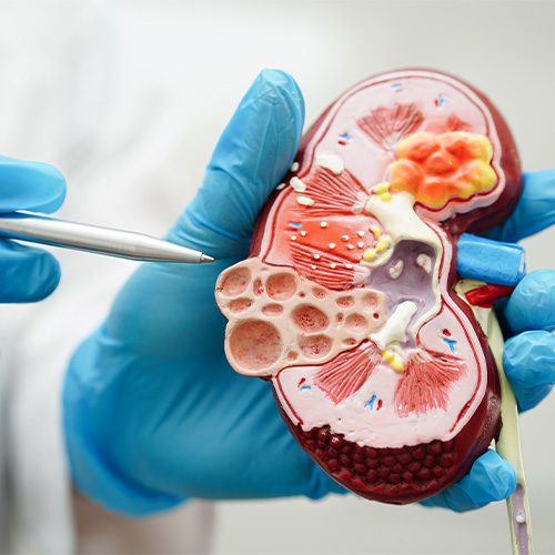 Urology Product List